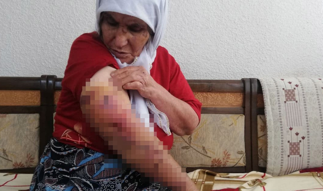 Köpeğin saldırısına uğrayan kadın ölümden döndü