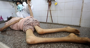 İsrail'in kıtlığı dayattığı Gazze'de son 24 saatte 3'ü çocuk 9 kişi daha açlıktan hayatını kaybetti