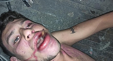 Hamam böceği yedirilen gencin dosyasında karar: Yağmadan beraat, hürriyeti tehditten 6 yıl 12 ay ceza