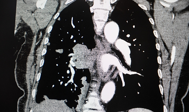 Profesörden korkutan sigara açıklaması: