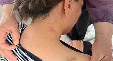 17 bıçak darbesi aldı, ölü numarasıyla kurtuldu, kocasının en ağır cezayı almasını istedi