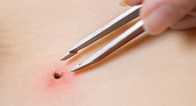 Tokat'ta 3 yaşındaki çocuğa kene tutundu, tedavi altına alındı