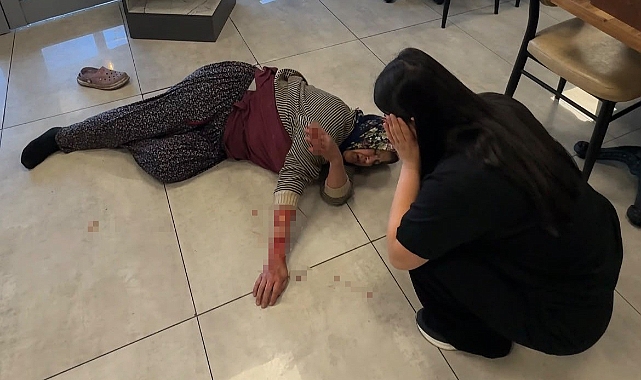 Tekmelere aldırmayan köpek kadının kolunu kopardı