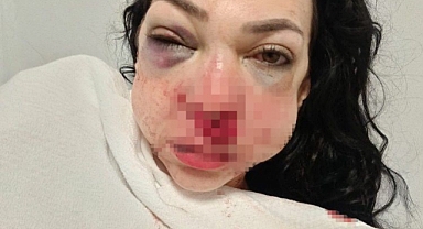 Anne ve oğlunun darbedildiği kafedeki dehşetin ilk duruşması görüldü