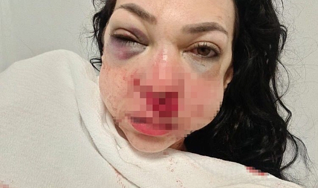 Anne ve oğlunun darbedildiği kafedeki dehşetin ilk duruşması görüldü
