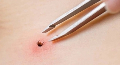 Tokat'ta 10 kişi KKKA hastalığı teşhisiyle tedavi görüyor